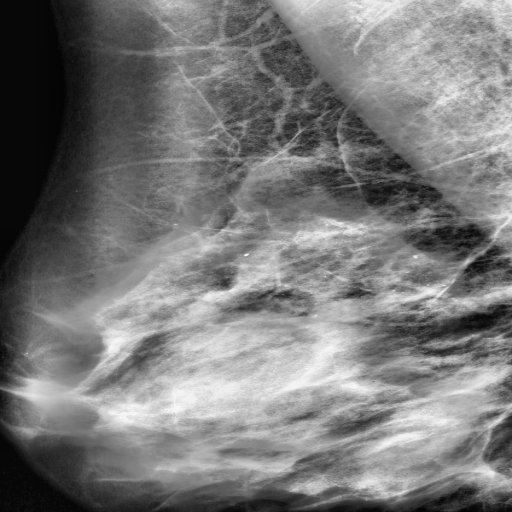 Mammography sample